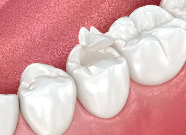 Best Dental Exams and Cleanings  in Mccleary, WA